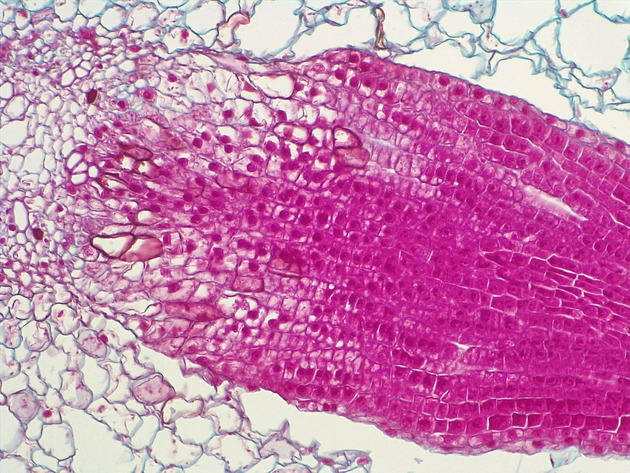 Dicot Lateral Root Slides - Dicot Lateral Root 01 200X